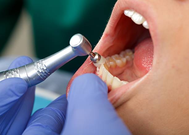 Best Root Canal Treatment  in Wadsworth, IL